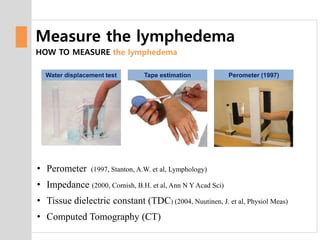 normal lymphedema measurements